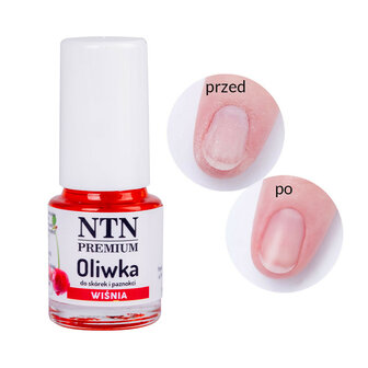 NTN Premium nagelriemolie met kersengeur voor nagelriem en nagels - 5ml