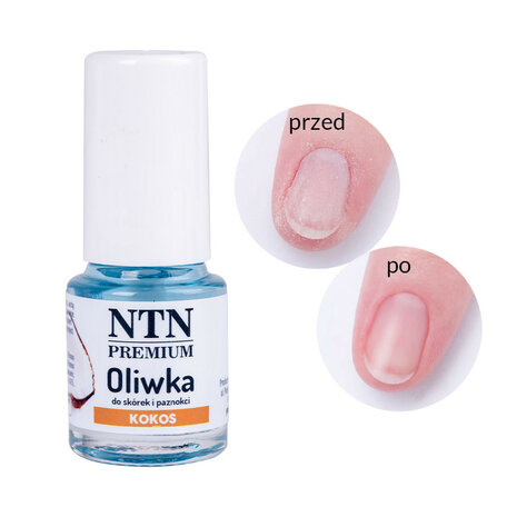 NTN Premium - Nagelriemolie - Kokos - 5ml